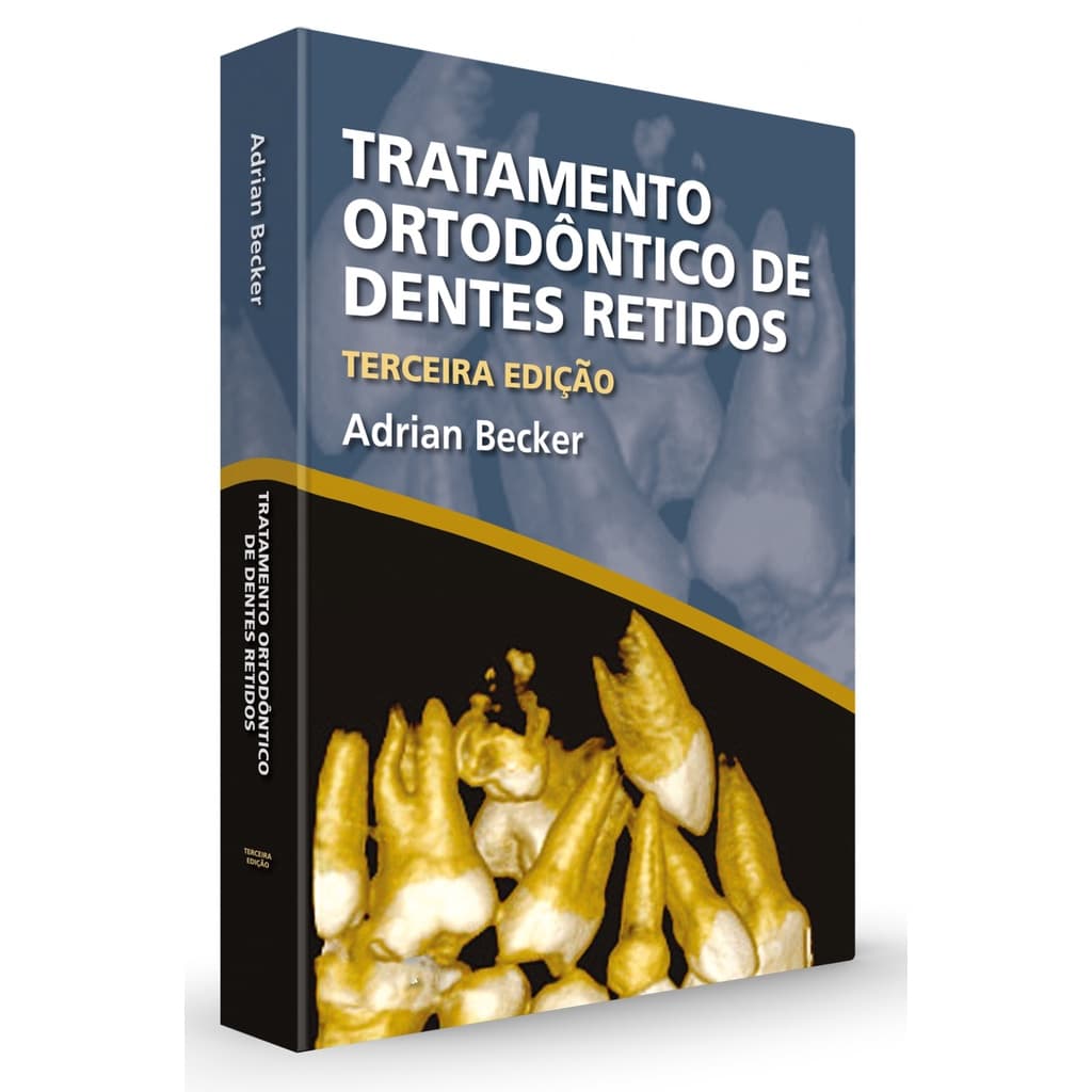 Livro Tratamento Ortodôntico De Dentes Retidos 3ª edição Adrian Becker