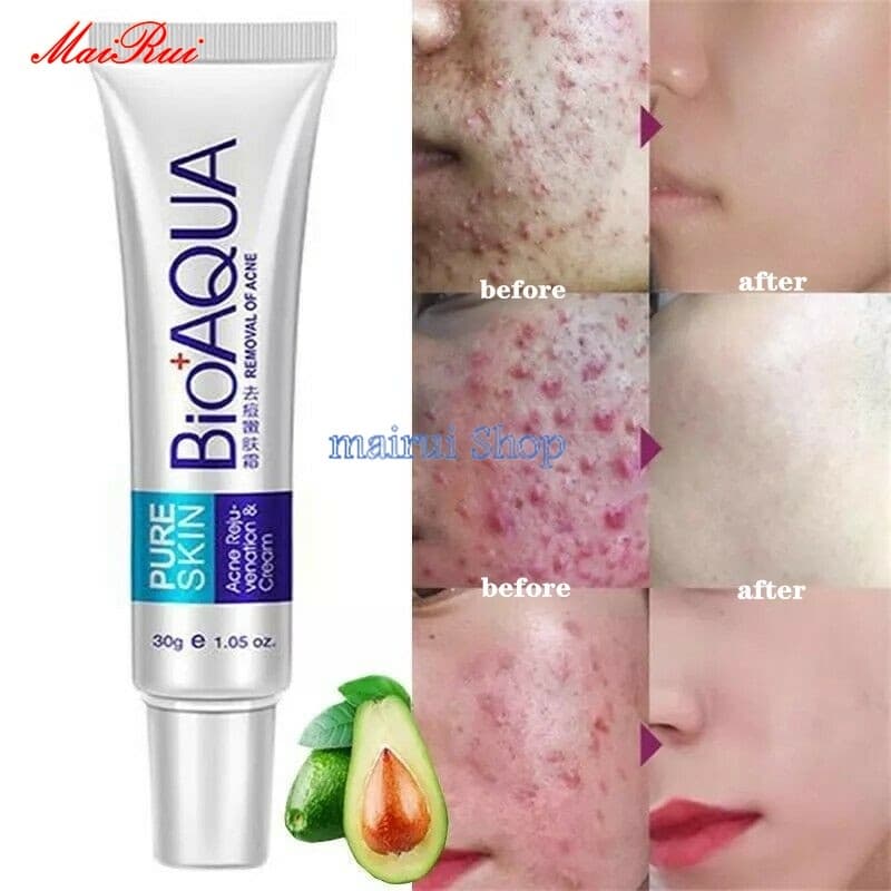 Bioaqua Facial Creme 30g /Cuirdado Facial Clareador Creme / Redutor De Poros Abertos / Controle de Oleos/ Poros de Pia/ Cicatriz De Acne Remoção/ Cuidados Rosto
