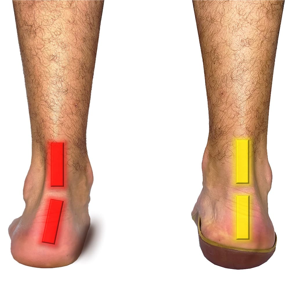 Palmilha Ortopédica Para Pisada Pronada Cappes Correção da Pronação Pisada Para Dentro