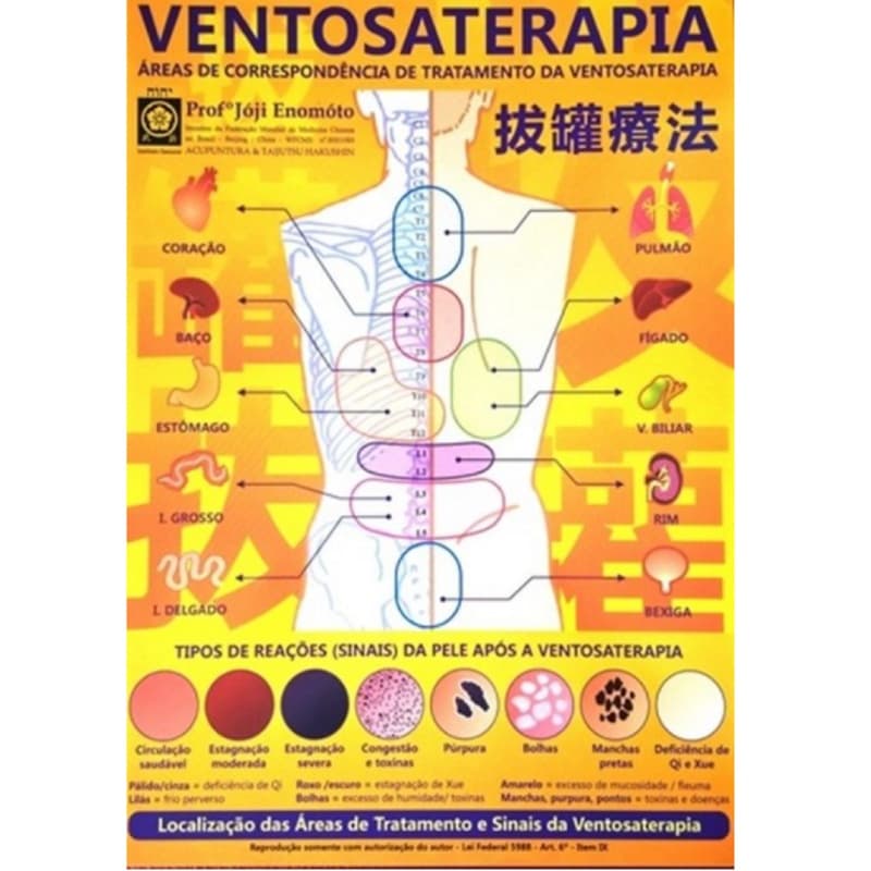 Mapa De Ventosaterapia - Joji Enómoto