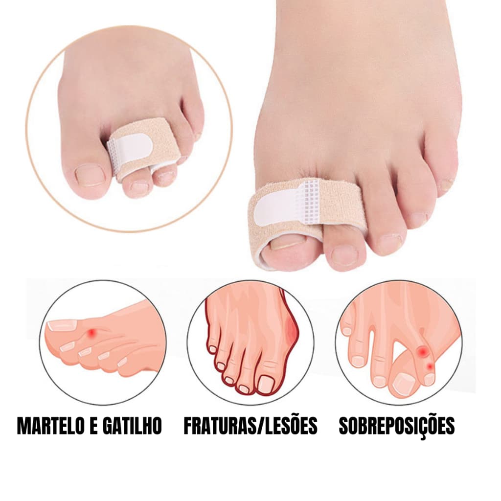 Tala Dedo Pé Quebrado Lesão Gatilho Martelo Ortopédica Corretiva Órtese Ajustável Bege