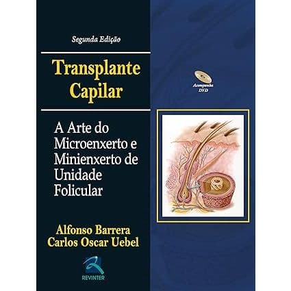 Transplante Capilar: A Arte do Microenxerto e Minienxerto de Unidade Folicular