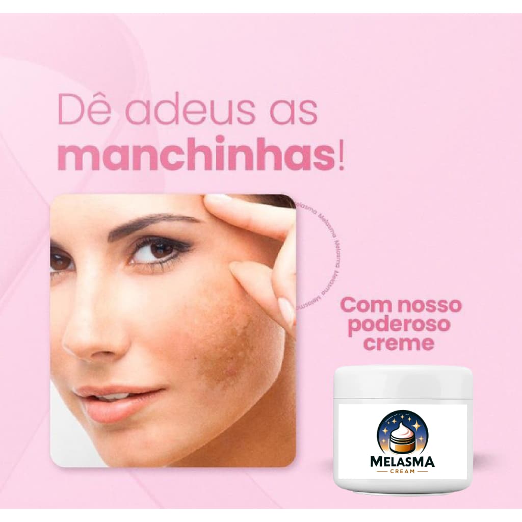 MELASMA CREME RENOVA PELE CLAREADOR FACIAL 30g - TIRA MANCHAS E MELASMA