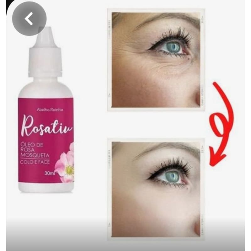 Óleo de Rosa Mosqueta Clareador de Pele Estrias- Rosto - Corpo Rosativ Abelha Rainha 30ml