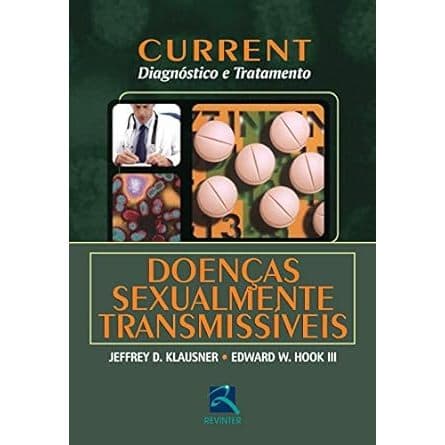 Current Doenças Sexualmente Transmissíveis: Diagnóstico e Tratamento Capa comum