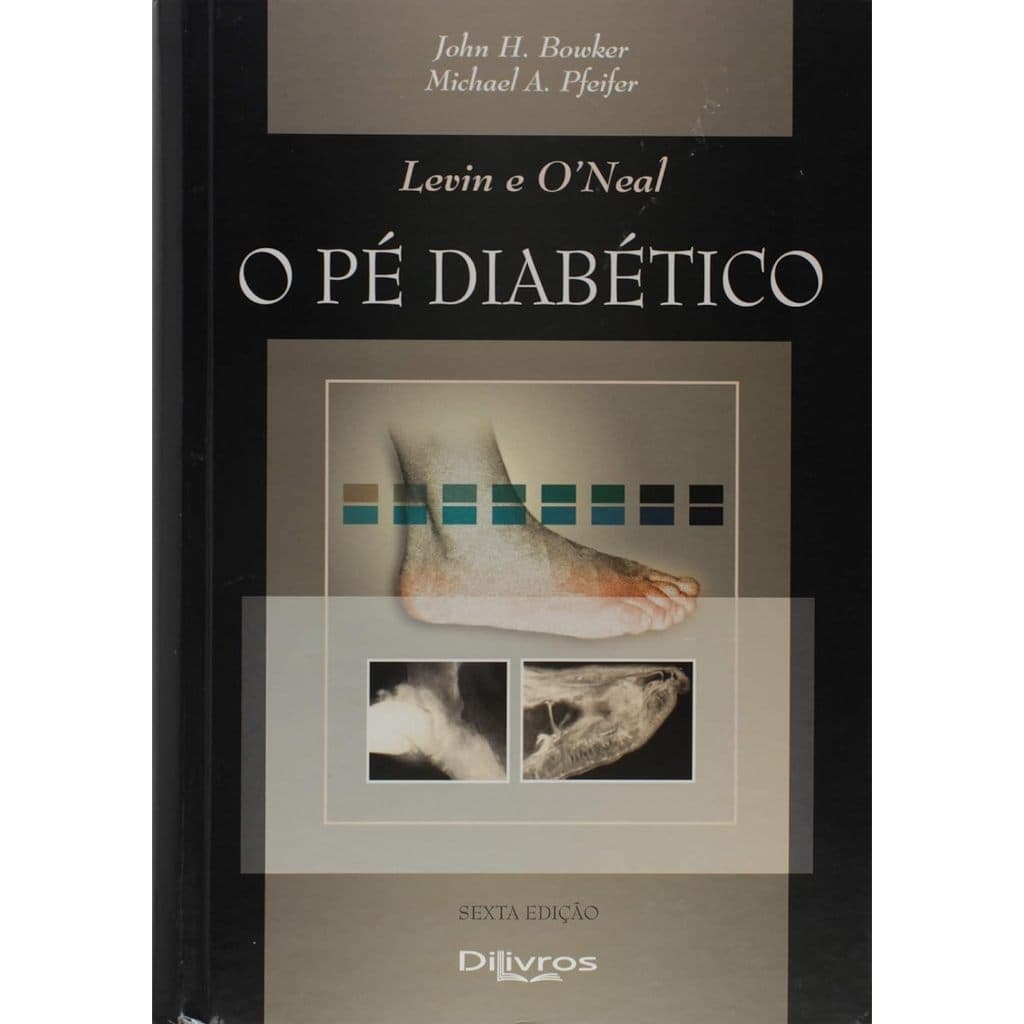 O Pé Diabético