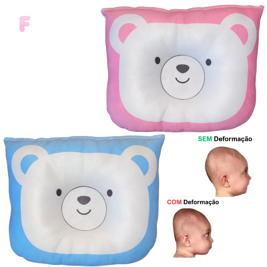 Travesseiro Plagiocefalia Bebê Respirável Hipoalergênico Ortopédico Modelador Anatômico Antiachatame