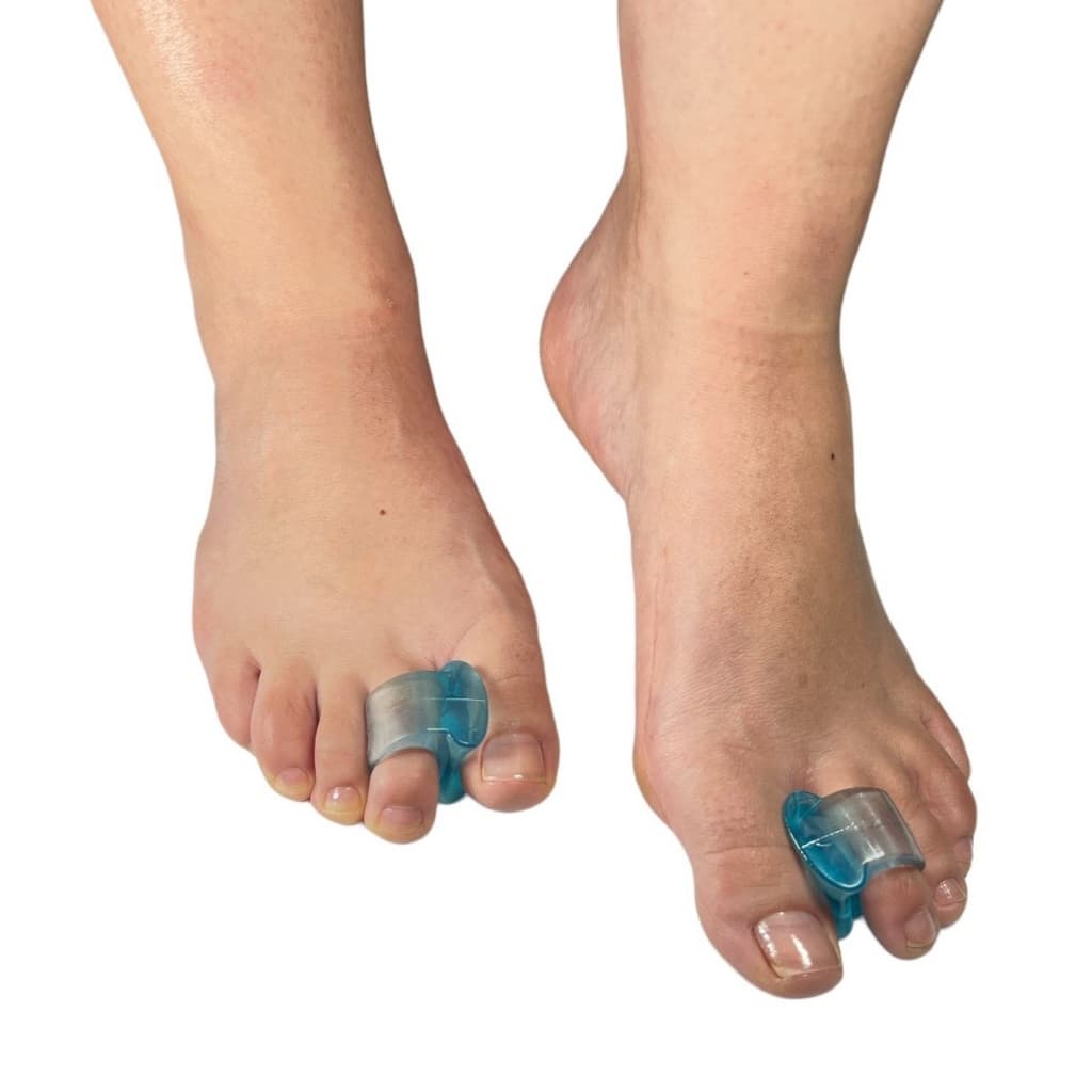 Par Separador De Dedos Corretor Pés Joanetes Alívio De Dores