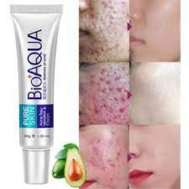 Creme Bioaqua Removal Anti Acne Cravos e Espinhas Machas Original com Selo de Garantia