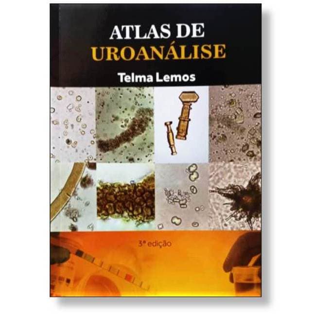 Atlas de Uroanalise - Telma Lemos Urinalise Urina Laboratorio