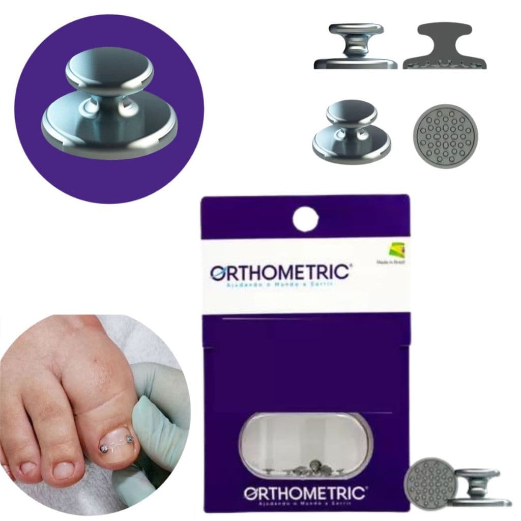 Botão Lingual Metal Colagem Ortodontia/Podologia C/10 Unid