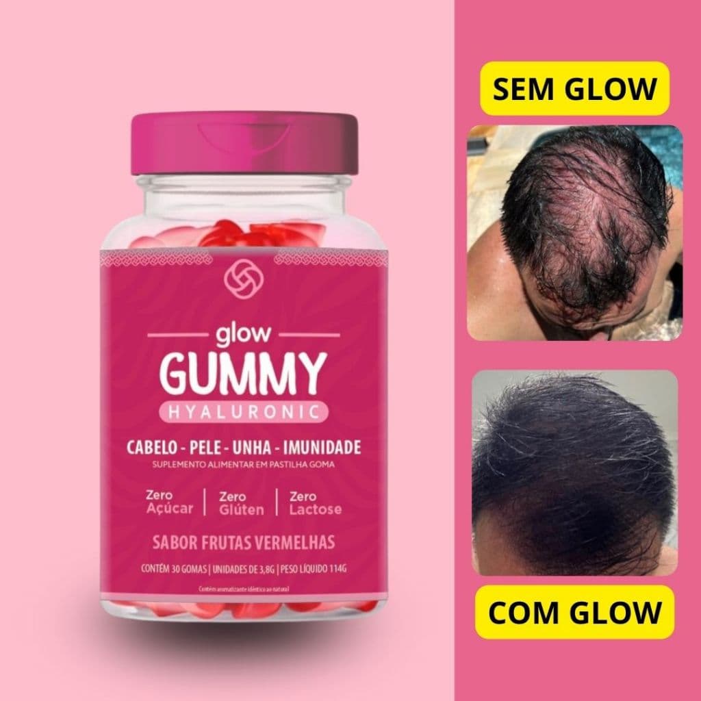 Gummy Goma de Vitamina para Crescimento Capilar c/ Ácido Hialurônico - 30 dias, Cabelos, Pele, Unhas- Envio Imediato