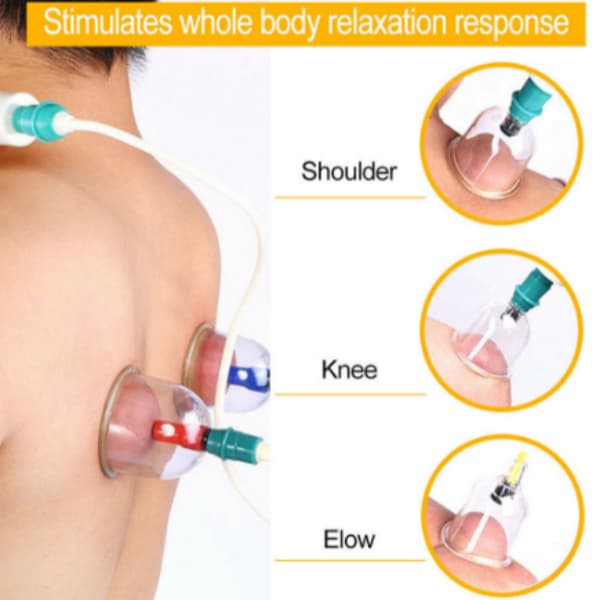 12 Peças Ventosas + Bomba,Para Terapia / Massagem / Cuidados Com A Saúde Kit De Ventosa Acrílico