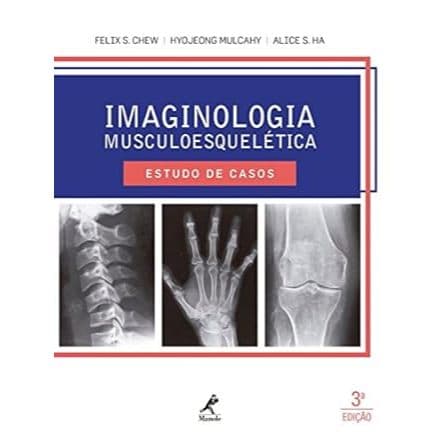 Imaginologia musculoesquelética: Estudo de casos Capa dura