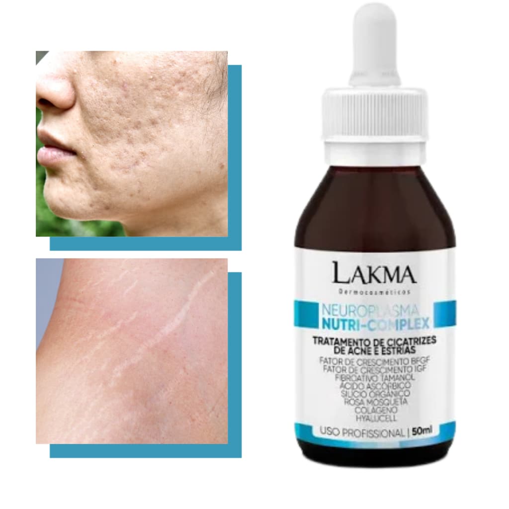 Fluido Para Cicatriz de Acne e Estrias Fator de Crescimento Nutri-Complex Lakma