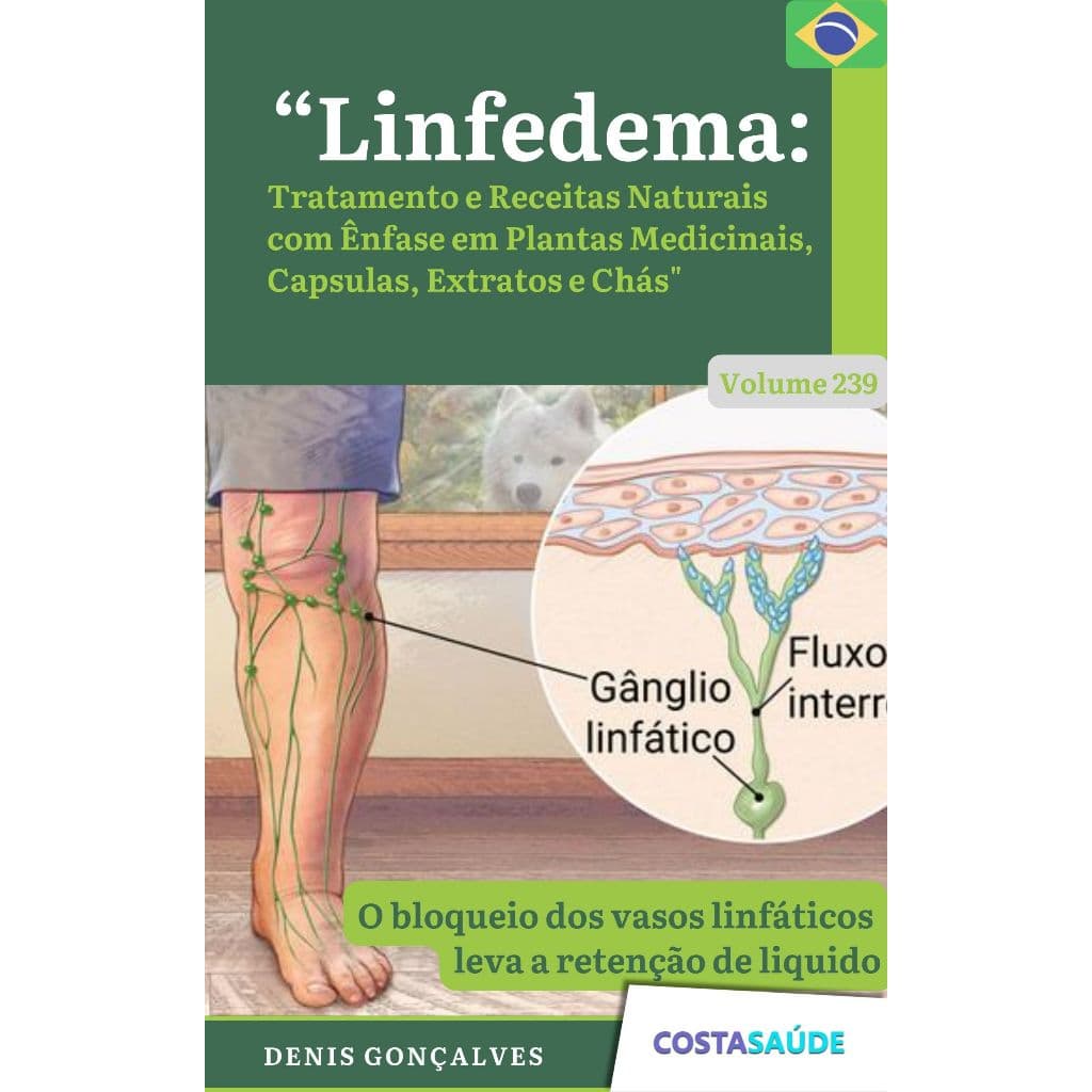 Linfedema: Tratamento e Receitas Naturais com Ênfase em Plantas Medicinais, Capsulas, Extratos e Chás - Volume 239