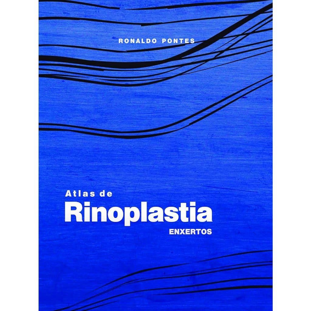Atlas de Rinoplastia: Enxertos por Ronaldo Pontes