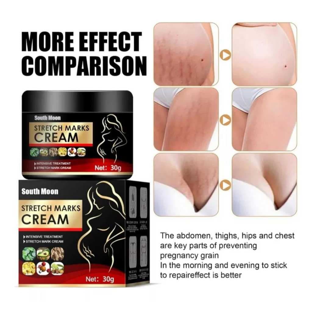 Creme Para Estrias e Cicatrizes