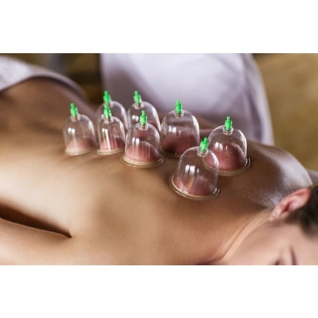 Kit 6, 12, 18, 24, 30 Ventosas Terapêuticas Ventosaterapia Massagem acupuntura massoterapia chinesa Vácuo Sucção + Bomba