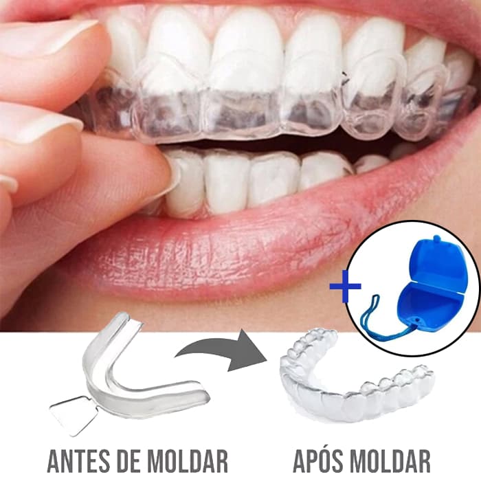 2 unidades (1 par) + Estojo - Moldeira Molde Silicone Bruxismo Protetor Bucal