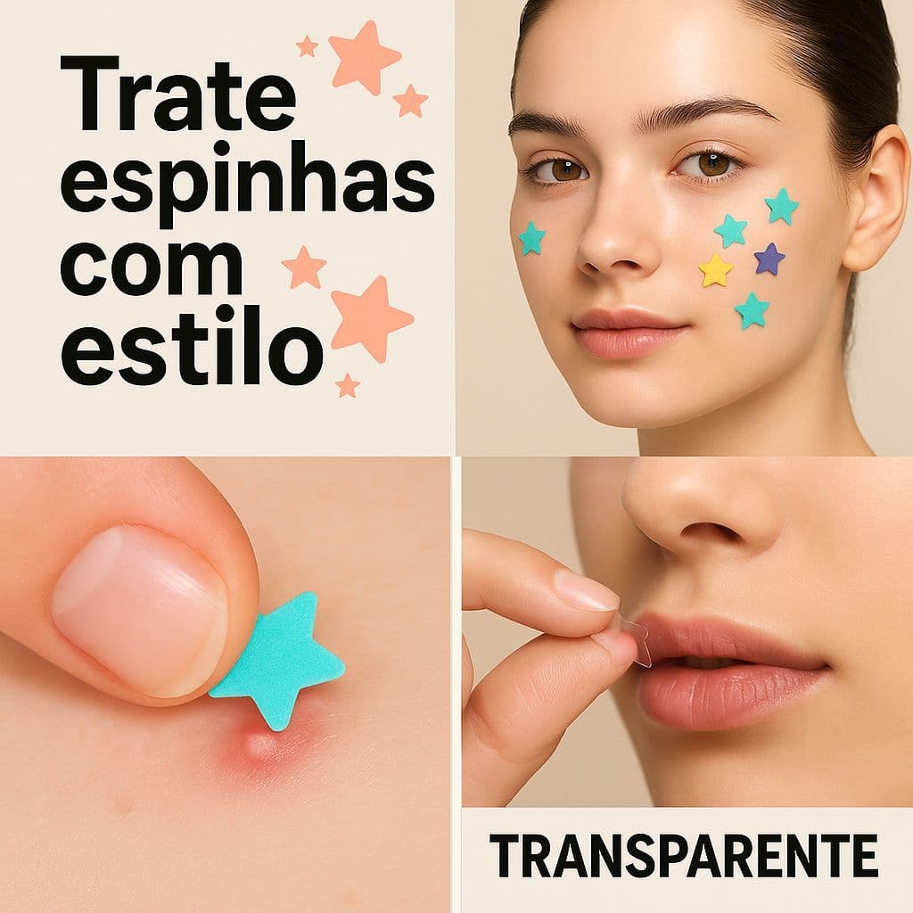 Adesivo para espinha secador de acne multicolorido, rapido e facil de usar, estrela funcional