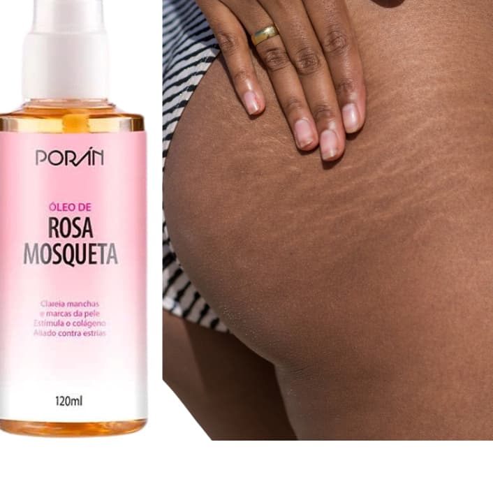 Óleo de Rosa Mosqueta Corporal Reduz e Suaviza Estrias Estimula o Colágeno 100% Puro 120ML