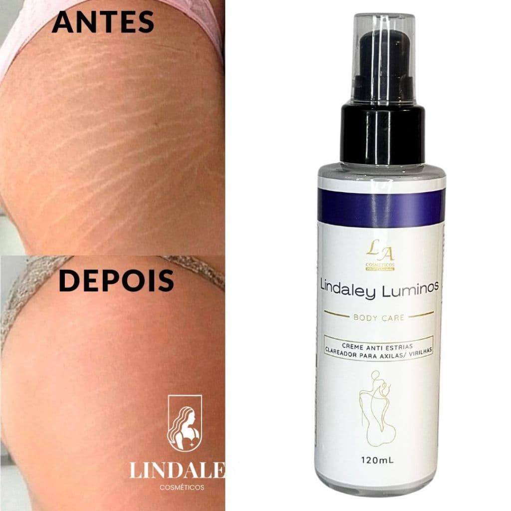 Lindaley Luminos - Anti Estrias - Clareador de Axila, Virilha, Joelhos 120ml - Entrega rápida
