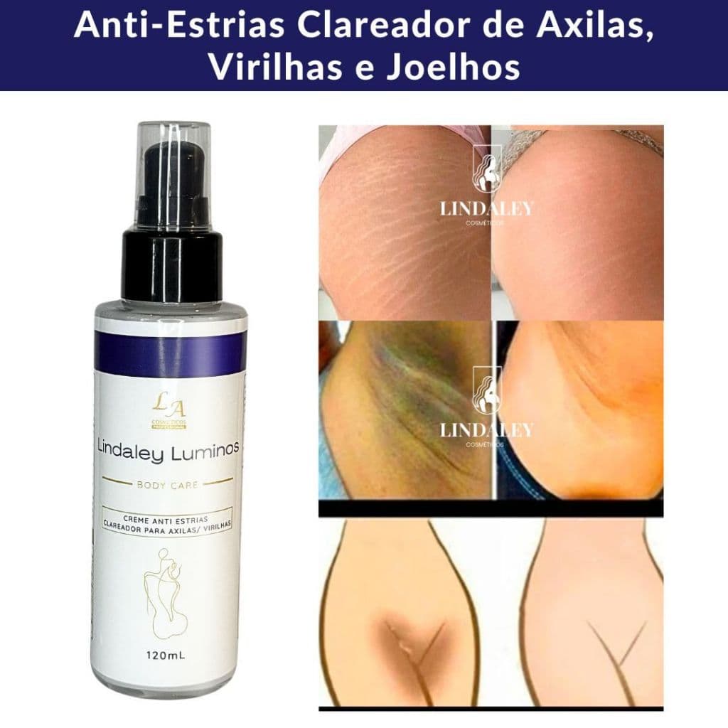 Lindaley Luminos - Anti Estrias - Clareador de Axila, Virilha, Joelhos 120ml - Entrega rápida