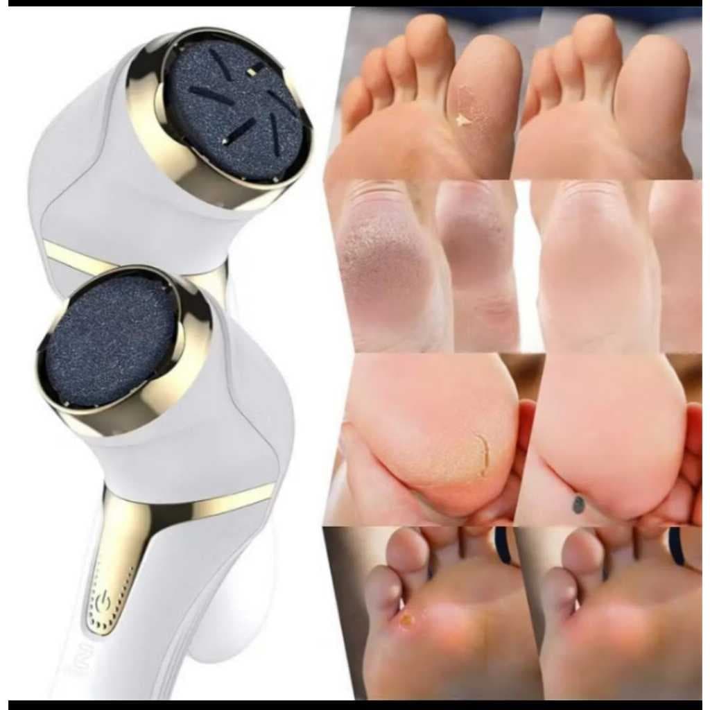 Esfoliador Elétrico Para Pés Portátil. manicure, podológa, uso doméstico