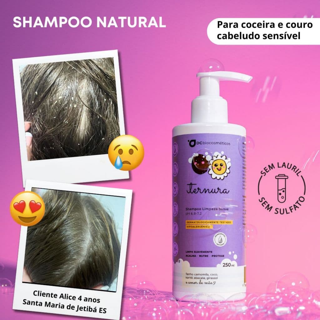 Shampoo Natural para Coceira, Dermatite, Couro Cabeludo Sensível