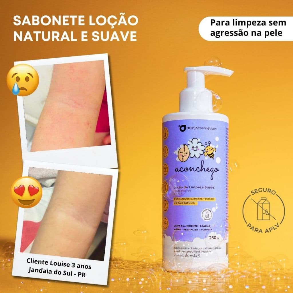 Sabonete Natural e Suave para Coceira, Pele Sensível, Dermatite, Psoríase [Dermatite Controlada]