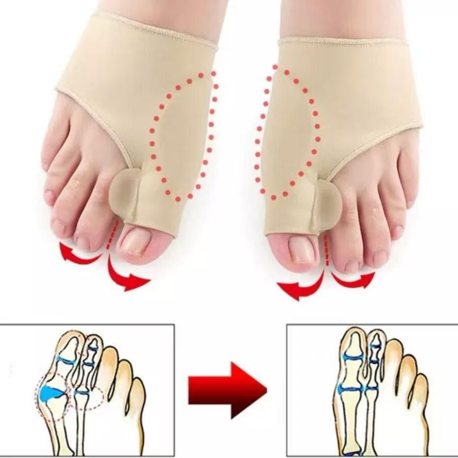 Par Meia Protetora Protetor Joanete Corretivo Ortopédico Alivia Dor Diurno e Noturno Reforçado-envio imediato