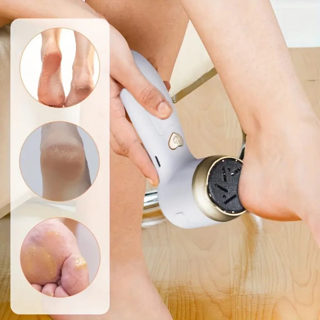 Lixador para os Pés Elétrico Portátil Recarregável USB Esfoliante para Pés Removedor de Calos Ferramentas Pedicure