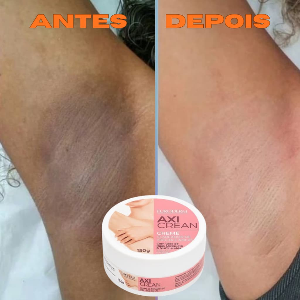 Creme Clareador de Axila e Virilha 150g – Clareia Manchas, Hidrata e Deixa a Pele Uniforme