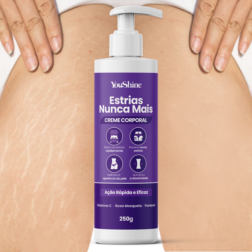 Creme Estrias Nunca Mais Antiestrias e Flacidez YouShine 250g com Elastina e Colágeno Ação Rápida