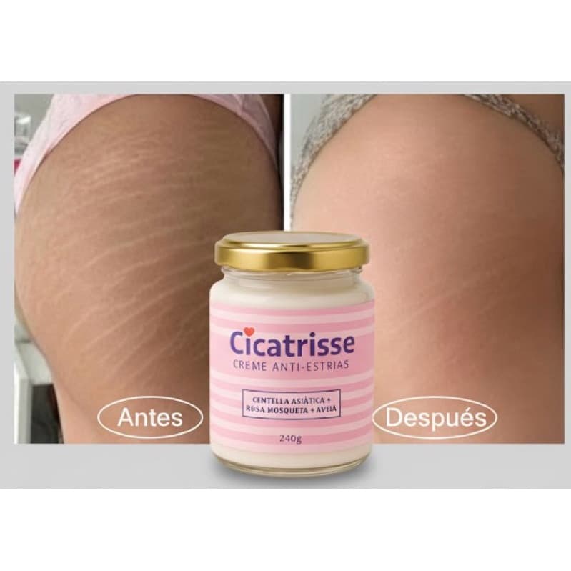 Cicatrisse Anti Estrias Brancas e Antigas Rosa Mosqueta Centella Asiática e Aveia