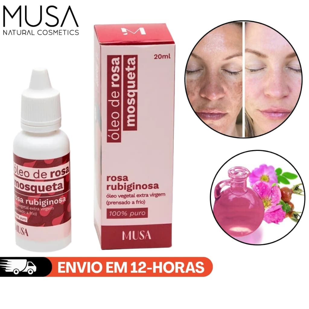 ÓLEO ROSA MOSQUETA RUBIGINOSA 100% PURO REGENERADOR 20ML MUSA