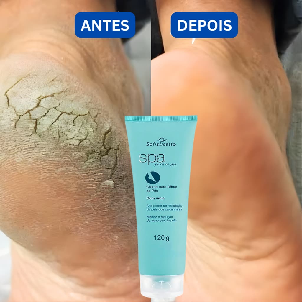 Creme spa dos pés de Pedreiro  para pe rachado pele ressecada Cotovelo Grosso Joelho Grosso Ureia