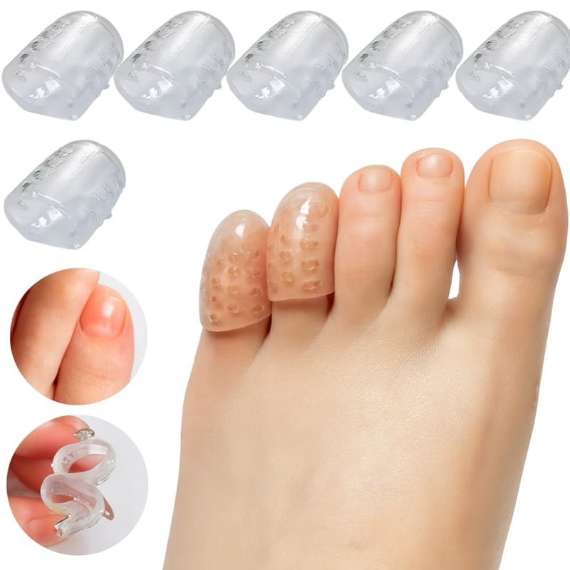 Dedeiras de Silicone Kit 5/10 Pares Protetor Calo Unha Encravada Para Dedo Dos Pés