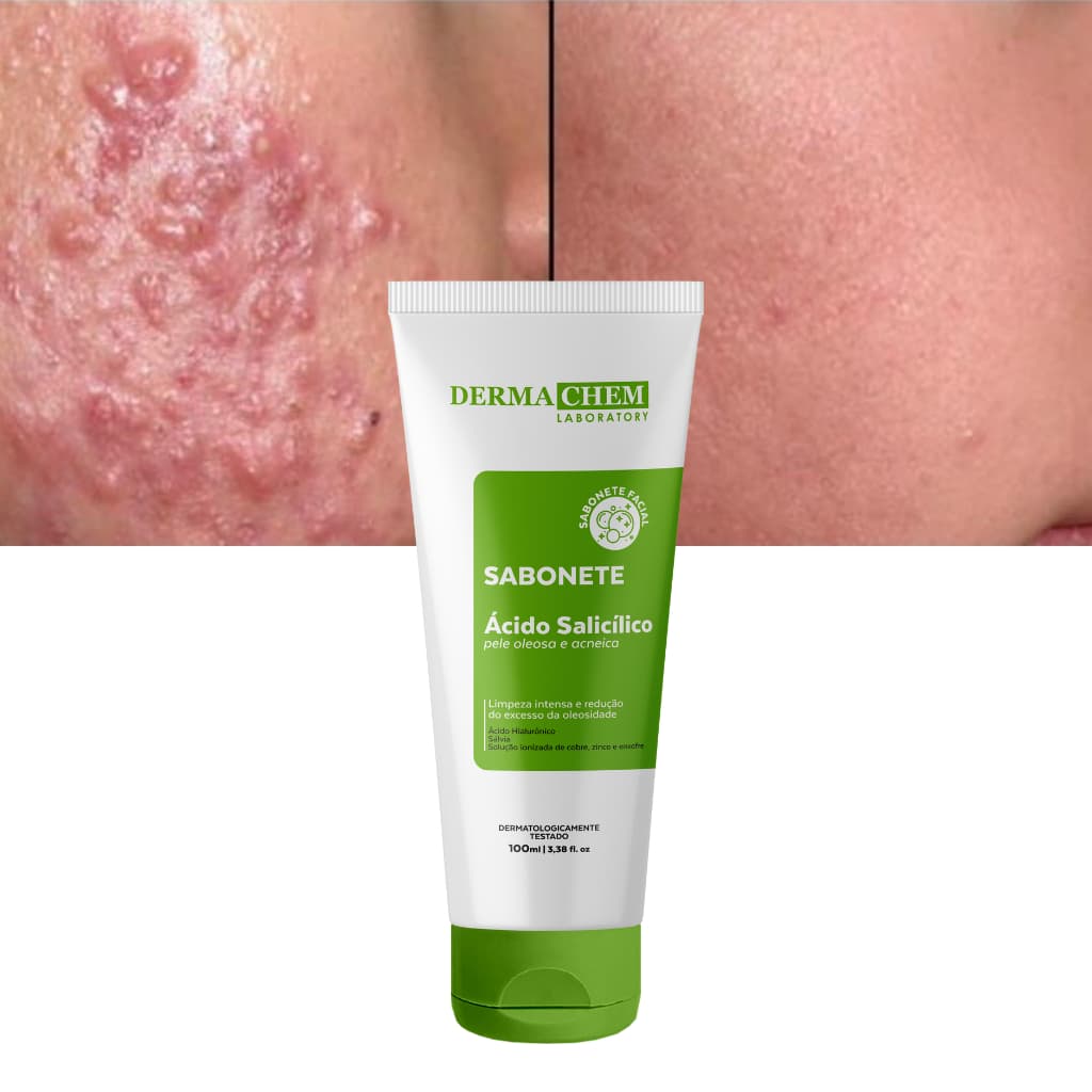 Sabonete Secativo Contra Pele Oleosa Ácido Salicílico Dermachem 100ml