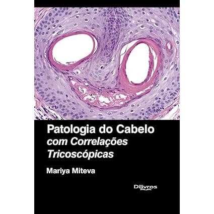 Patologia do Cabelo com Correlações Tricoscopias Capa dura