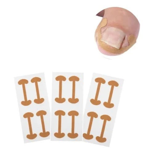 Kit 12 Adesivos Desencrava Unha Encravada Órtese Corretora Podologia Pedicure