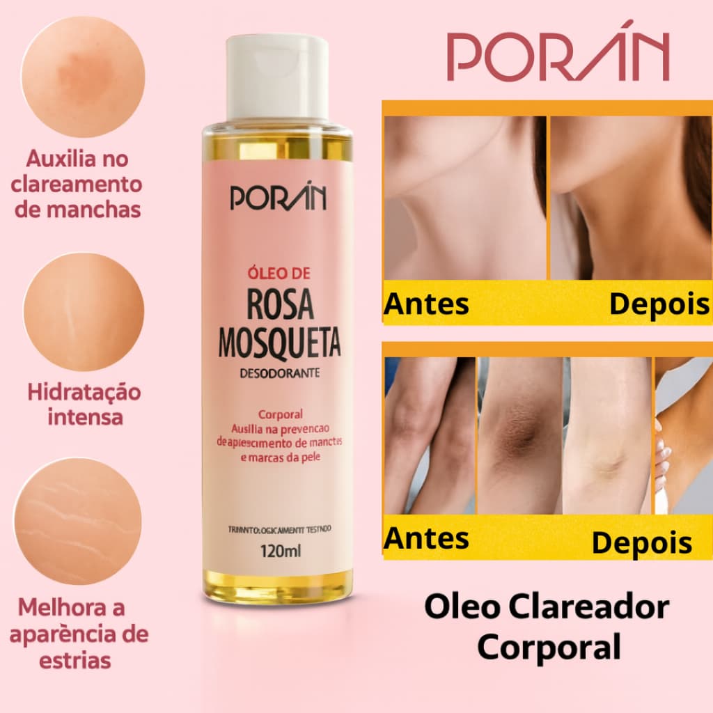 Óleo Corporal Rosa Mosqueta Puro Clareador Manchas, Estrias, Cicatriz e Super Hidratante 120ml Porán