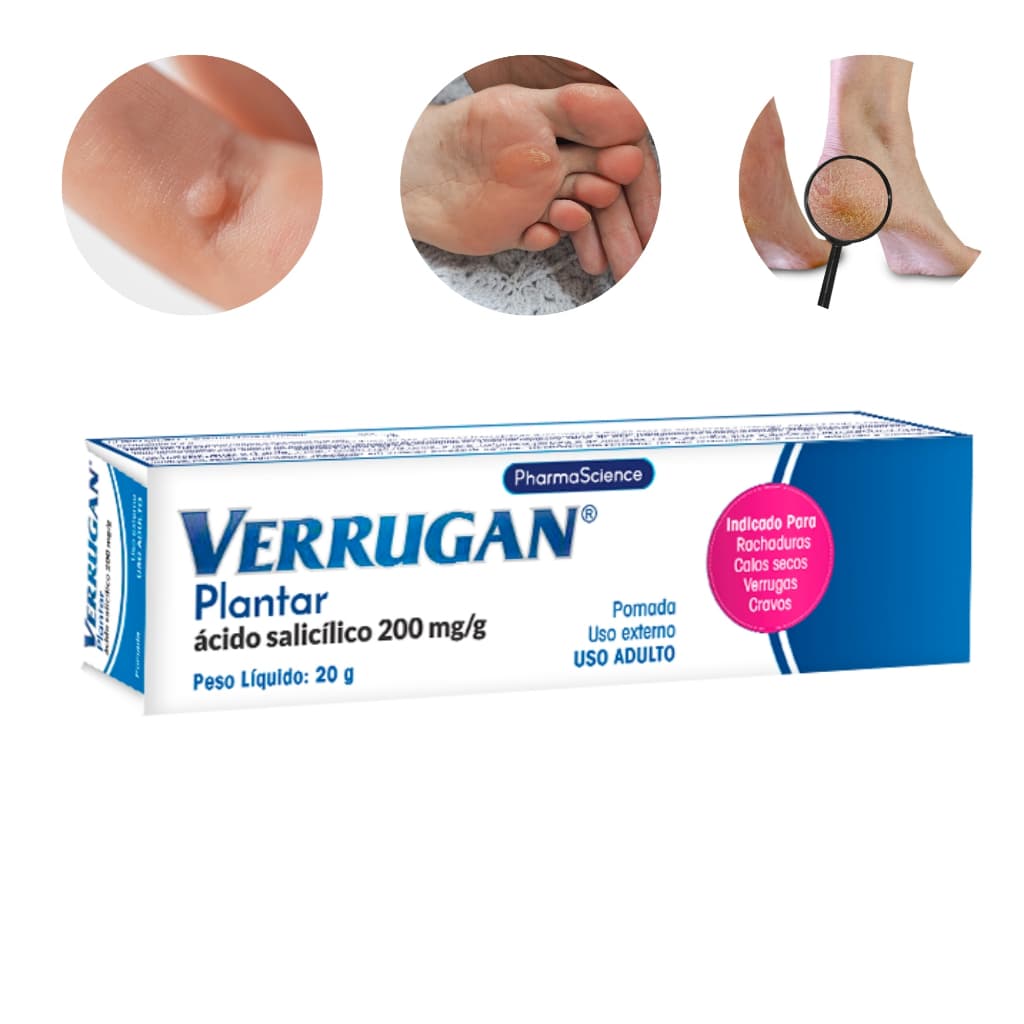 Verrugan Plantar 20g