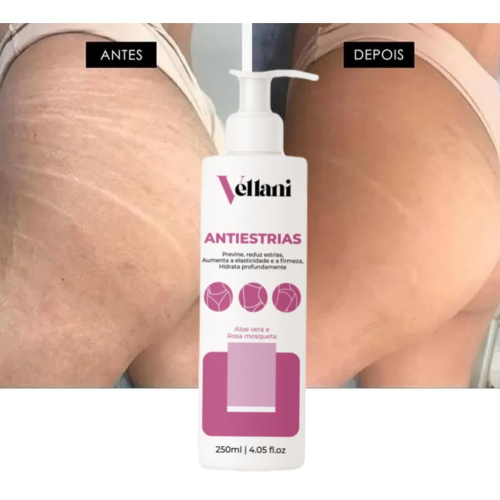 Creme Anti-Estrias Vellani 250ml – Adeus Estrias Antigas e Novas! Pele Renovada e Firme