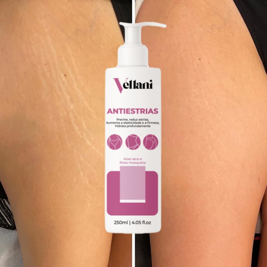 Creme Antiestrias Vellani 250ml – Estrias Antigas e Novas – Mais Firmeza e Elasticidade