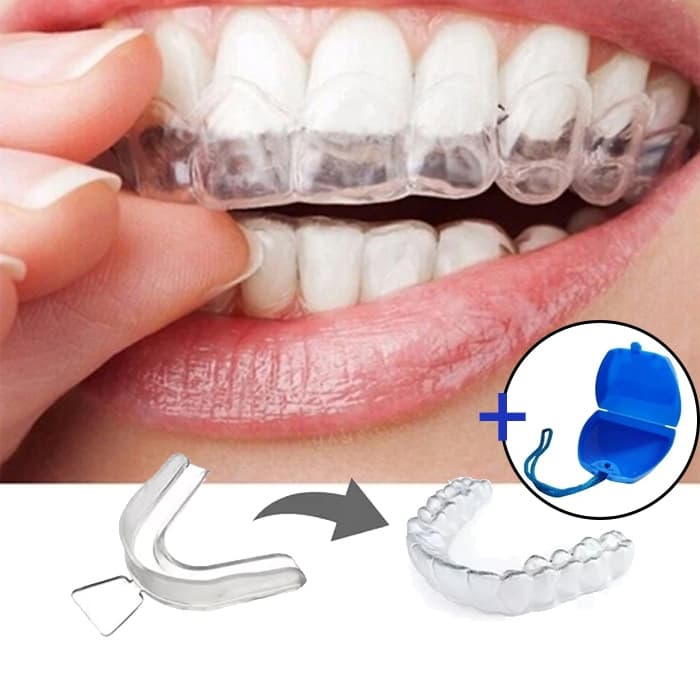 Kit 6 Placas Bruxismo Moldeira de Silicone Molde Caseiro Aparelho Inferior e Superior + ESTOJO