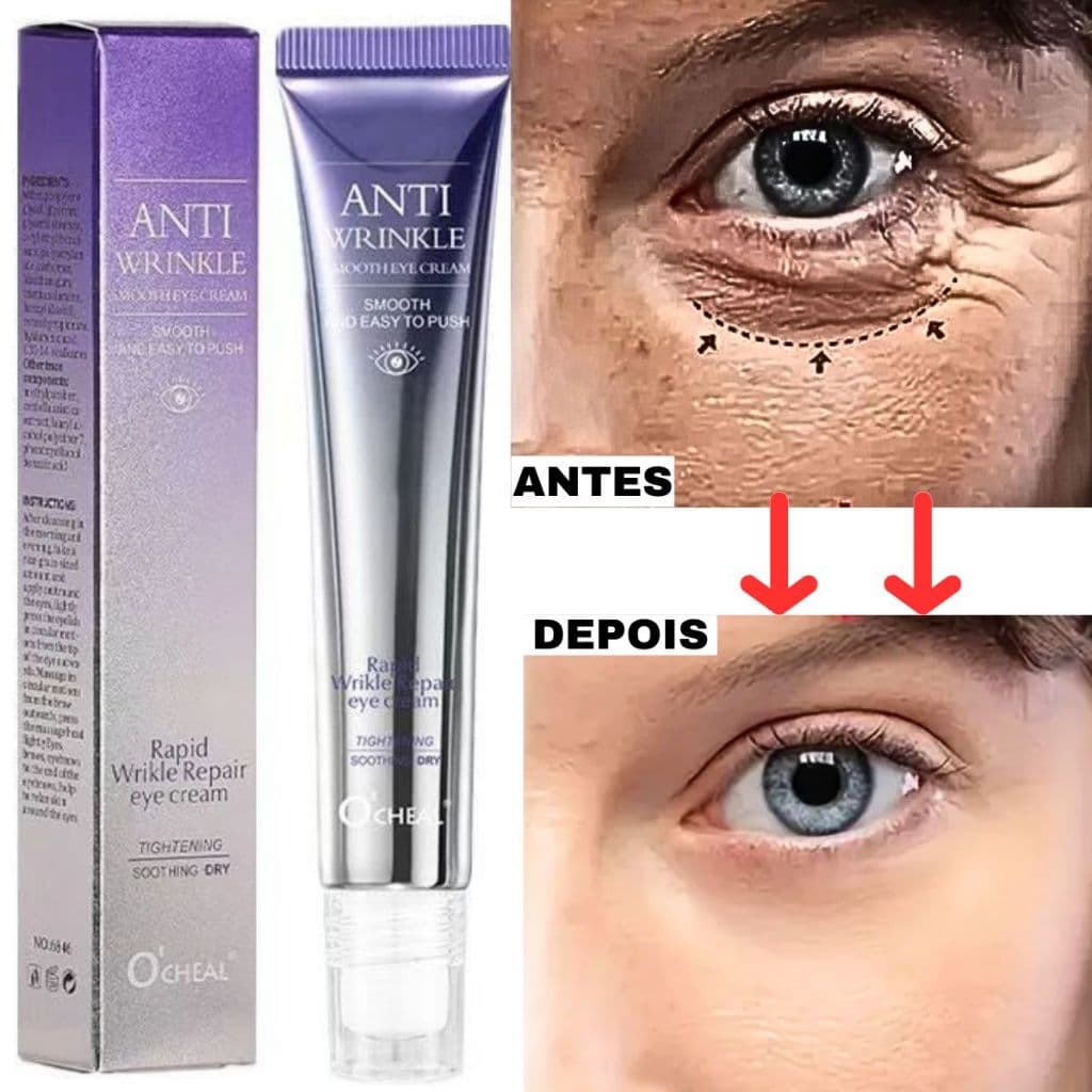 Creme para Rugas Profundas e Bolsas nos Olhos | Efeito Lifting Instantâneo