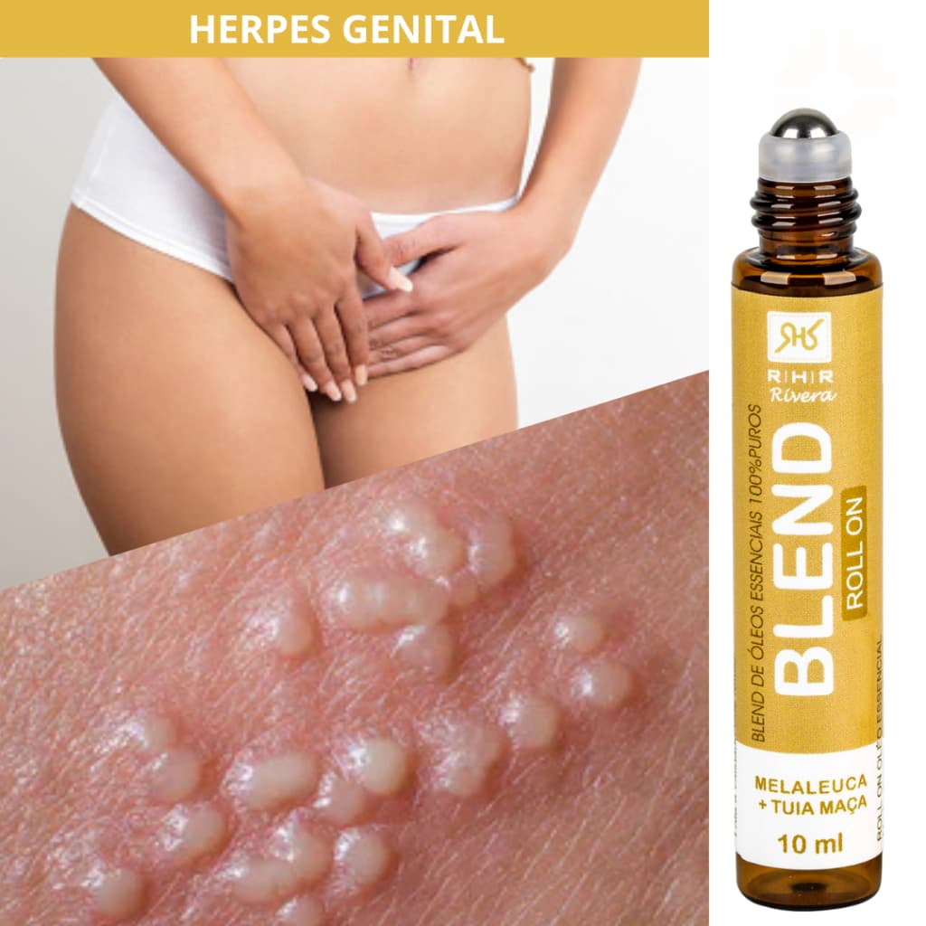 Blend Roll-on - Herpes Genital