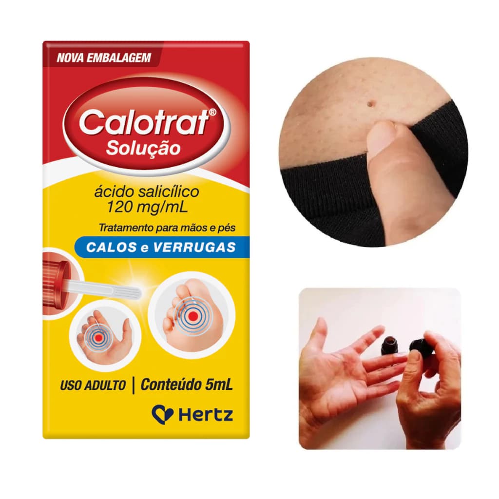 Calotrat 5ml Anti Verrugas Calos Calosidades